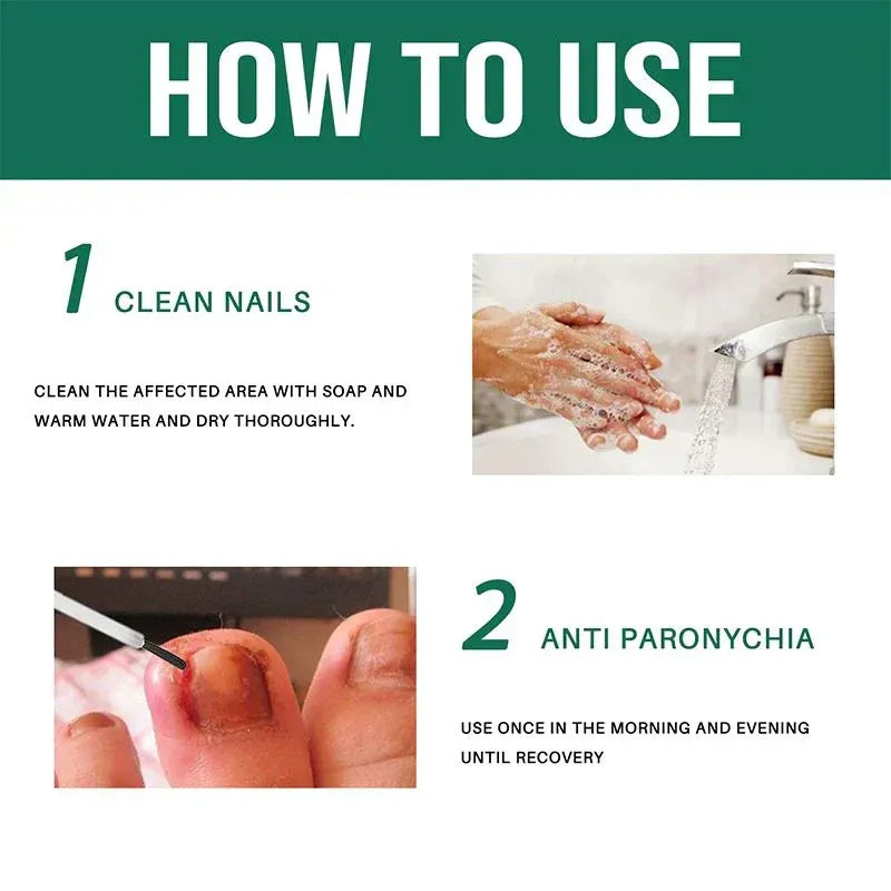 Anti-Paronychia Relief Oil  (BUY 1 GET 1 FREE)