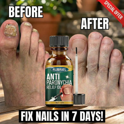 Anti-Paronychia Relief Oil  (BUY 1 GET 1 FREE)